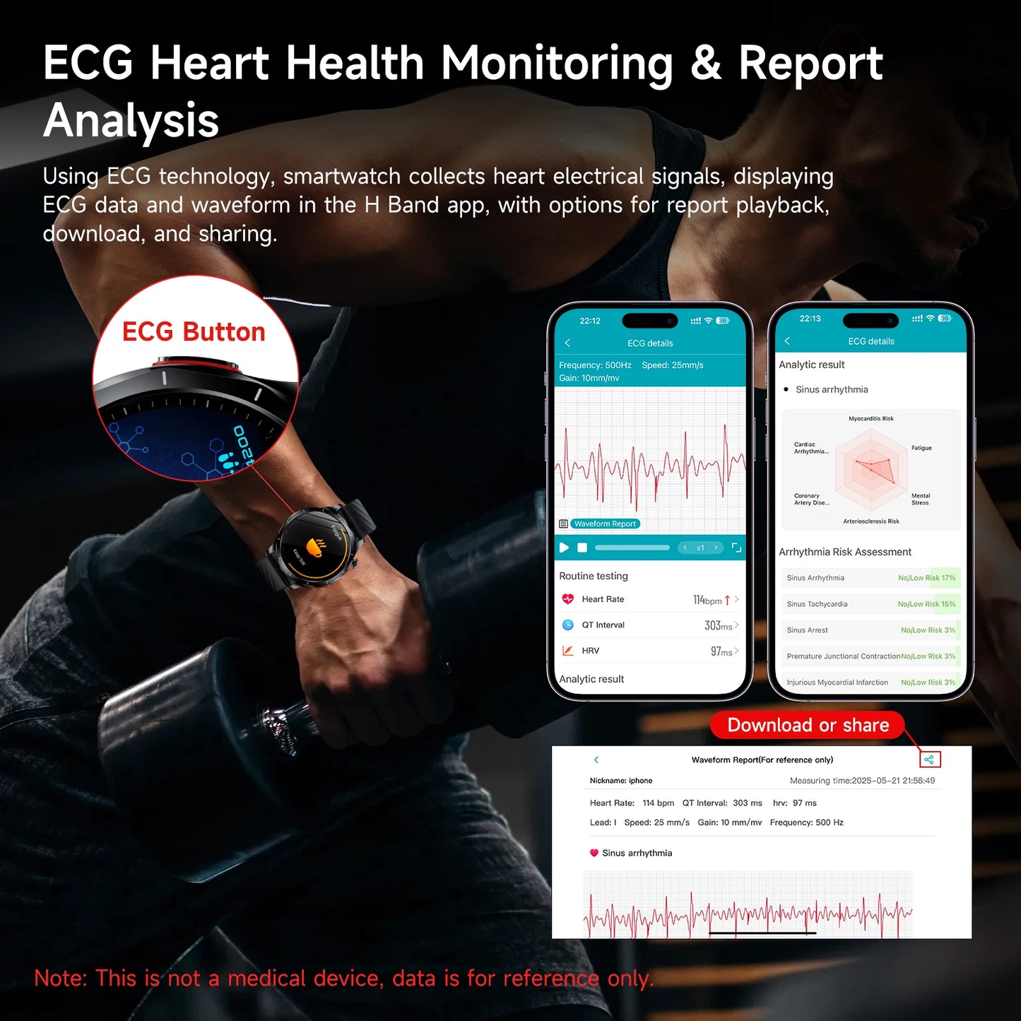 Marsyu Integrated Health Smartwatch Supporting Ecg And Ppg Monitoring
