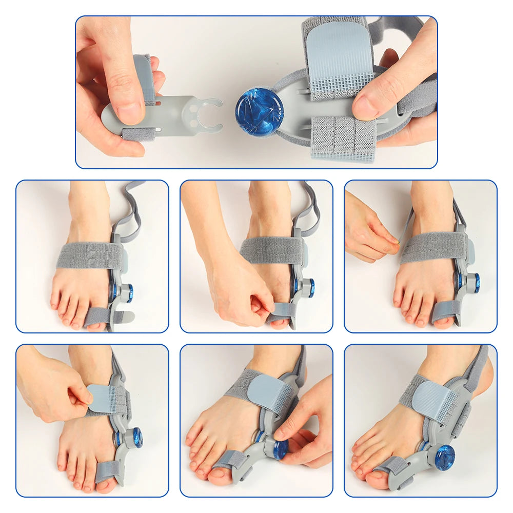 Moajaza Adjustable Bunion Corrector With Toe Straightener Brace