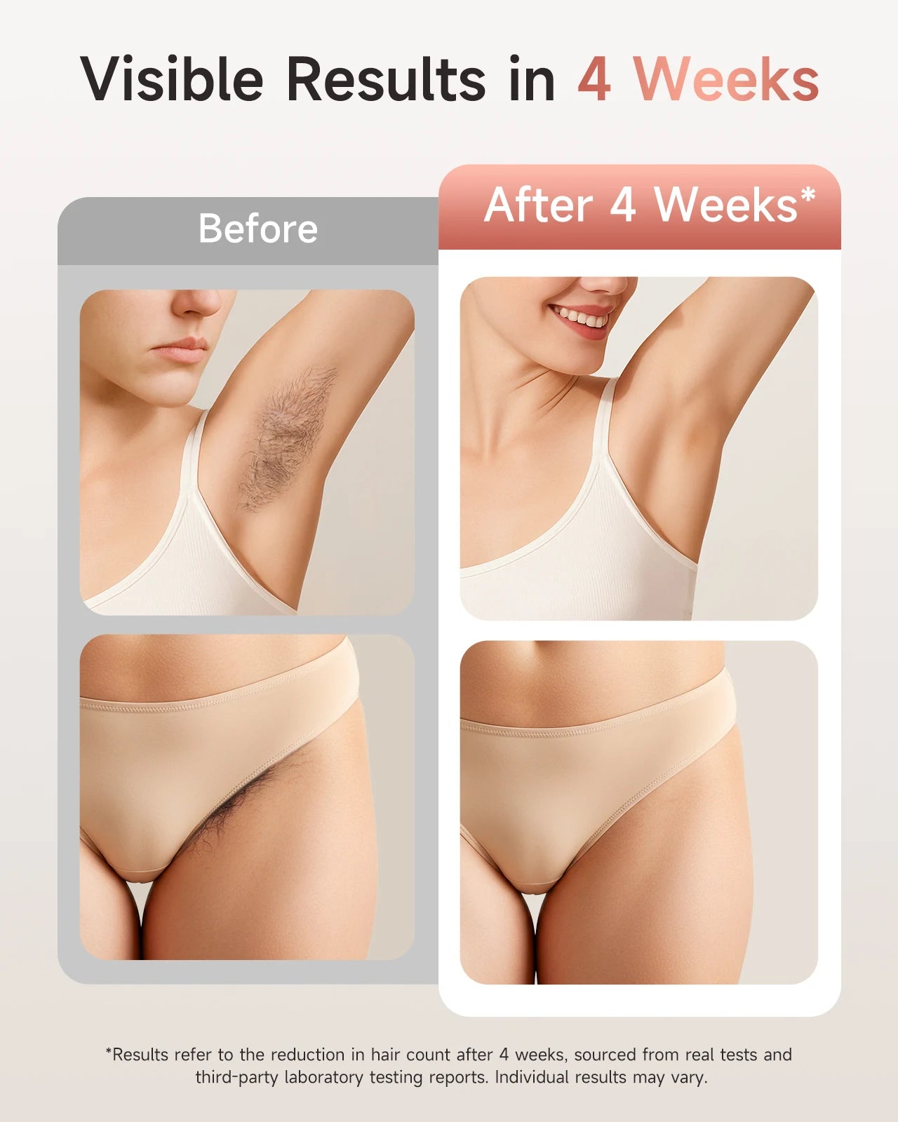 LYSMOSKI Unlimited Flashes IPL Hair Removal Device For Home Use